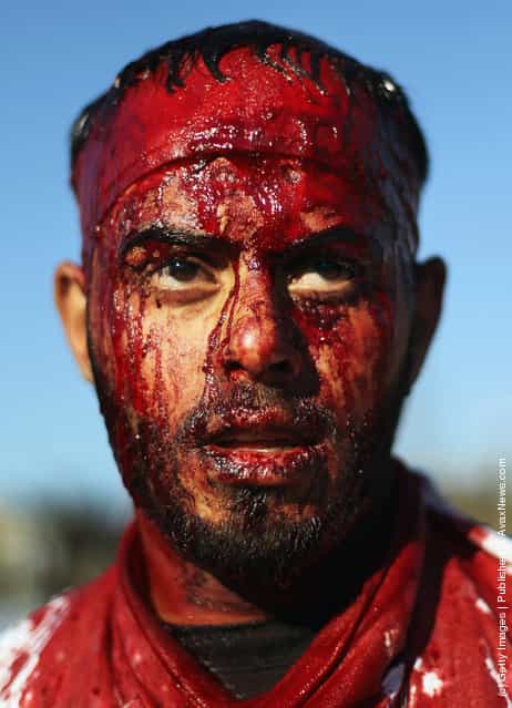 A Shiite worshiper bleeds after cutting his scalp in a ritual display of mourning during an Ashura commemoration ceremony outside Kadhimiya shrine in Baghdad, Iraq