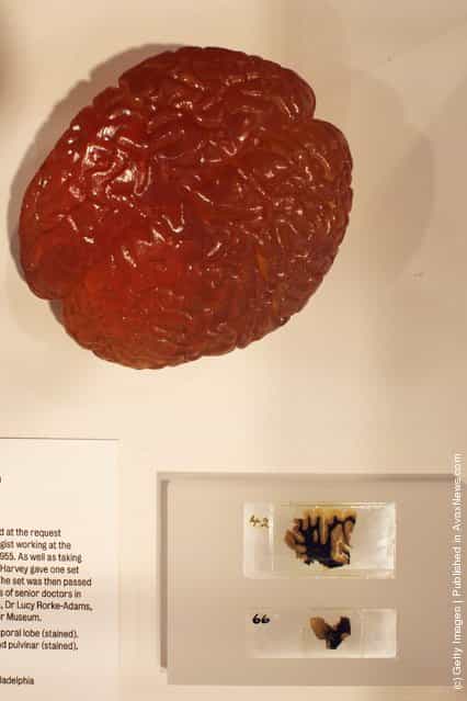 Slices of Albert Einsteins brain (bottom right) are displayed at the Wellcome trusts new Brains exhibition