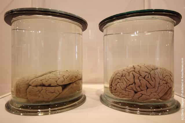 Preserved brains are displayed at the Wellcome trusts new Brains exhibition at the Wellcome Collection