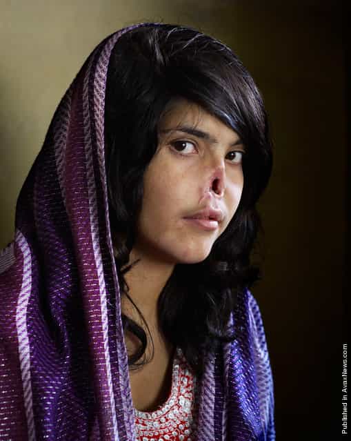 In this image, the winner of the World Press Photo Contest 2011 by Jodi Bieber, South Africa, Institute for Artist Management for Time magazine, is Bibi Aisha, an 18-year-old woman from Oruzgan province in Afghanistan, who fled back to her family home from her husbands house, complaining of violent treatment