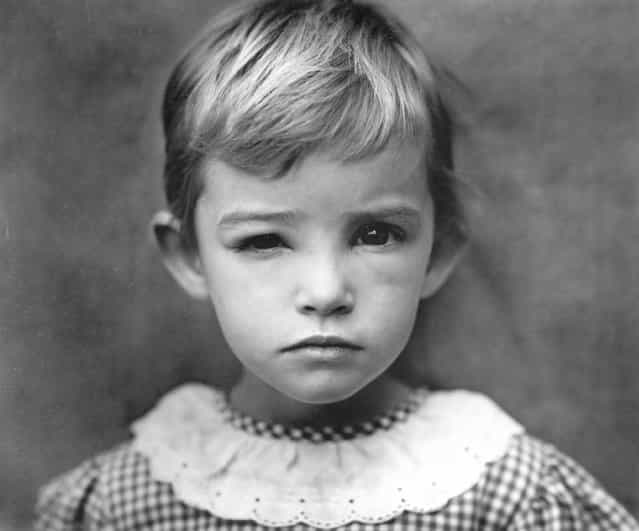 Damaged Child, 1984. (Photo by Sally Mann)