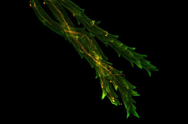 Wheat stigma infected with Claviceps fungus, by Dr. Fernán Federici, University of Cambridge, Plant Sciences Department, Cambridge, UK, and Dr. Anna Gordon, NIAB, Cambridge, UK. (Photo by Olympus BioScapes)