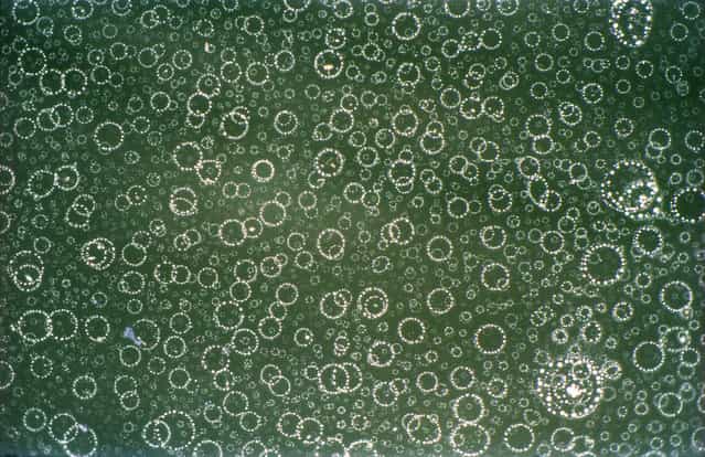Serum arrested mouse L-1210 cells engaged in spontaneous apoptosis (programmed cell death) after nutrient depletion and acid hydrolysis, by Dr. Frank Abernathy of Jamestown, Ohio. (Photo by Olympus BioScapes)