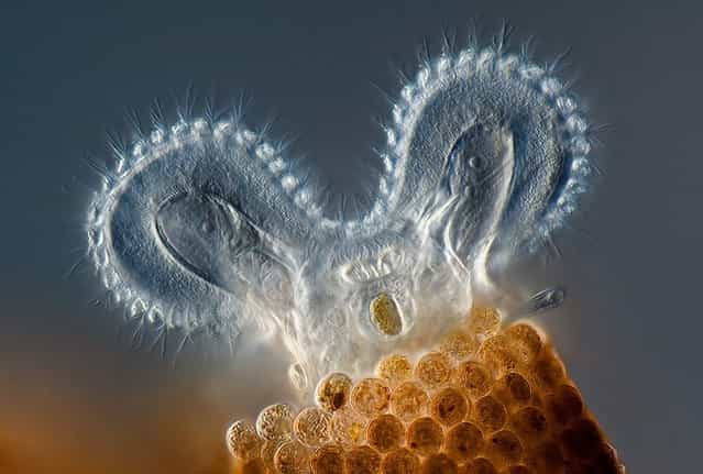 First prize winner: Rotifer Floscularia ringens feeding. Its rapidly beating cilia (hair-like structures) bring water that contains food to the rotifer. The [wheel animacules] were first described by Leeuwenhoek (ca.1702); when their cilia beat, they look like they have two wheels spinning on top. They live in reddish-brown tubes made of spherical [bricks]. Charles Krebs, Issaquah, Washington. (Photo by Olympus BioScapes)