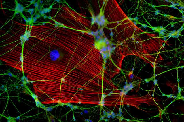 Neuronal culture, fluorescence, six images stitched at 40x magnification, by Jan Schmoranzer, Freie University Berlin, Institute for Chemistry and Biochemistry, Berlin, Germany. (Photo by Olympus BioScapes)