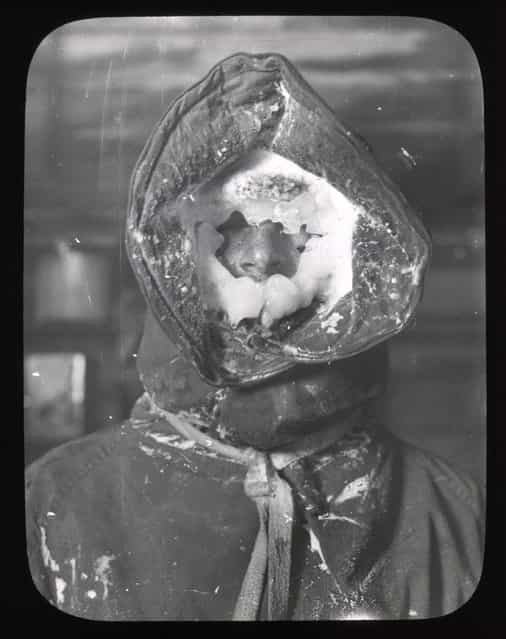 The icy face of a member of the Australasian Antarctic Expedition team, 1911-1914. Probably the face of the team meteorologist, C.T. Madigan