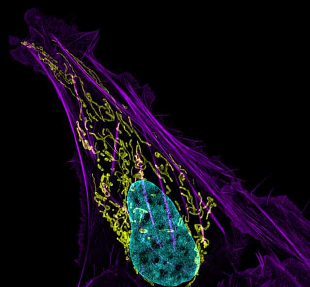 Nikon Small World Photomicrography Competition 2012. 3rd Place. [Human bone cancer (osteosarcoma) showing actin filaments (purple), mitochondria (yellow), and DNA (blue) (63x)]. (Photo by Dr. Dylan Burnette, National Institute of Health (NIH) Bethesda, Maryland, USA)