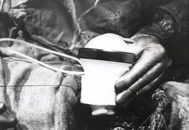 Dr. Michael Debakey installs an artificial pump to assist a patient's damaged heart in Houston, on July 19, 1963. (Photo by AFP Photo) Dr. Michael Debakey installs an artificial pump to assist a patient's damaged heart in Houston, on July 19, 1963. (Photo by AFP Photo)