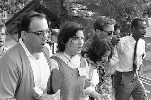 Allison Turaj, 25, of Washington, D.C., blood running down her cheek, was cut over her right eye by a thrown rock in a mass demonstration at a privately owned, segregated amusement park in suburban Woodlawn in Baltimore, on July 7, 1963. (Photo by AP Photo)