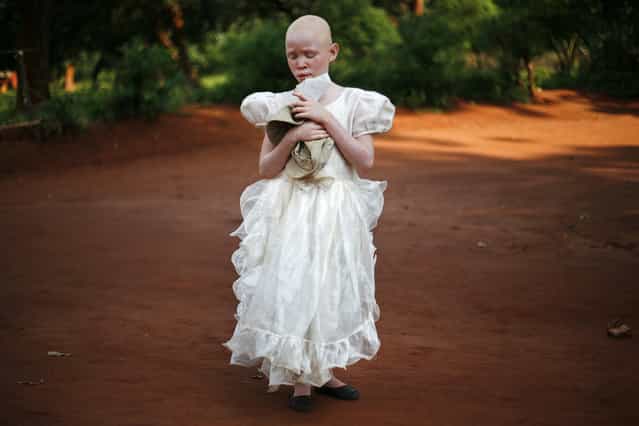 [Visually Impaired Malawian Albino Girl Stands In The Dusty Road]. In the dusty road, wearing a beautiful white dress stands a timid little albino girl. Clutching hat and paper she remains quietly still. Afternoon light seeps through trees making her glow angelically. Visually impaired she lives in Malingunde Village attending school at the Special Needs Education Resource Centre along with other such challenged Malawian children. Location: Special Needs Education Resource Centre, Malingunde Village, Malawi, Africa. (Photo and caption by Mark Wessels/National Geographic Traveler Photo Contest)