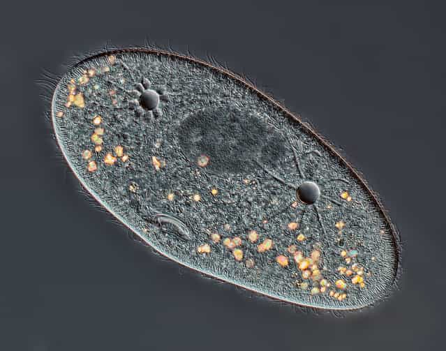 Taking 4th place, a 40x image of Paramecium sp. showing the nucleus, mouth and water expulsion vacuoles, by Rogelio Moreno Gill, from Panama City, Panama. (Photo by Rogelio Moreno Gill)