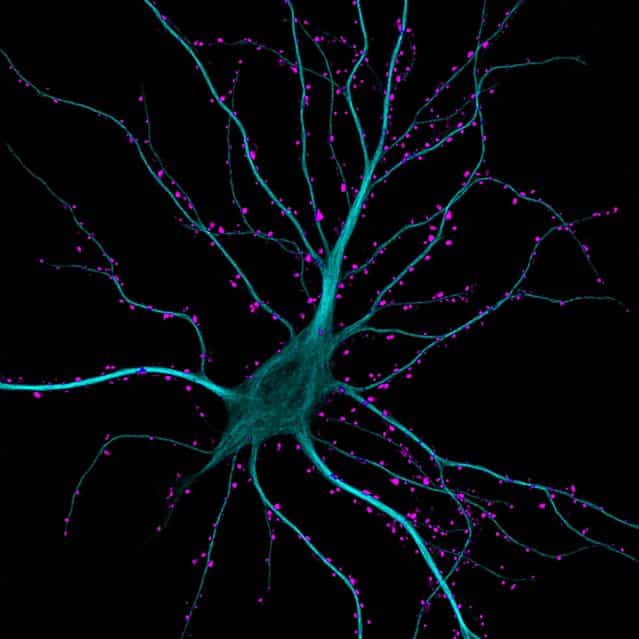 Dr. Kieran Boyle of the University of Glasgow, in Scotland took this image of a brain cell in the hippocampus, receiving excitatory contacts. It is enlarged 63 times. (Photo by Dr. Kieran Boyle)
