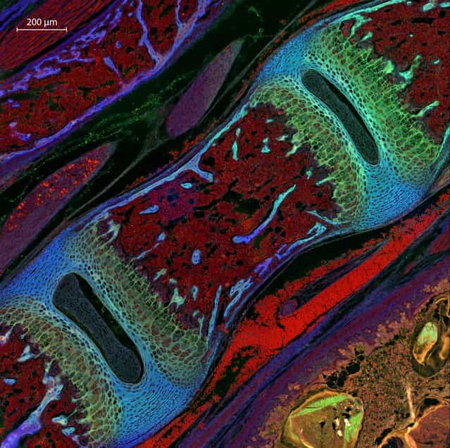 Dr. Michael Paul Nelson and Samantha Smith, of the University of Alabama at Birmingham, took this image of a section of the vertebra of a mouse, magnified 200 times. (Photo by Michael Paul Nelson/Samantha Smith)