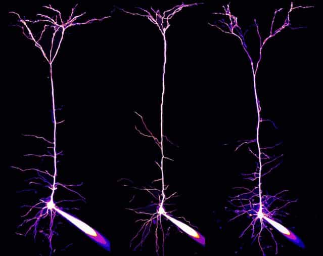 Dr. Alexandre William Moreau, of the University College London in the U.K., took this image of a special type of brain cell called pyramidal neurons, in the visual cortex of a mouse brain, enlarged 40 times. (Photo by Alexandre William Moreau)