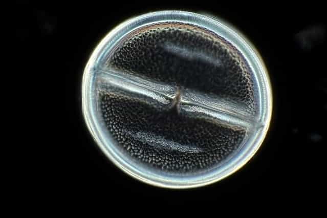 IOD: Mr. Arturo Agostino, of Reggio Calabria, Italy, took this picture of a tiny diatom called Navicula variolata, magnified 400 times. (Photo by Arturo Agostino)