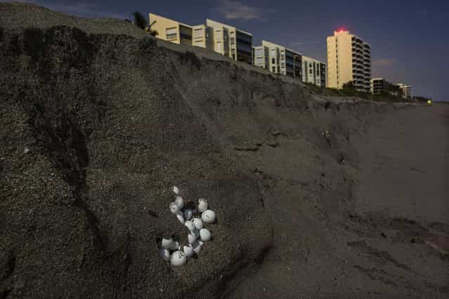 Turtle eggs are exposed along the shoreline after high surf carved out the sand. (Photo by Greg Lovett/The Palm Beach Post)
