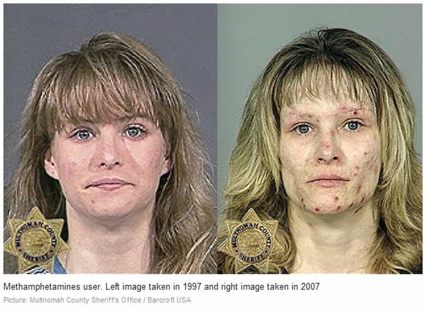 Pics Photos Pictures Crystal Meth Users Methamphetamine Effects Making