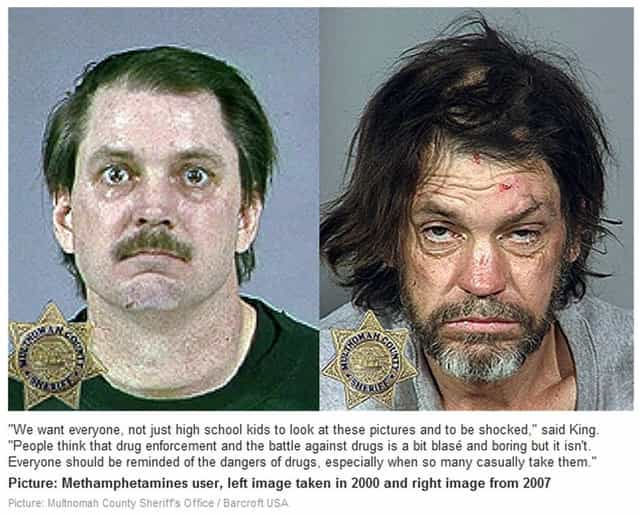 Methamphetamine. Before and After