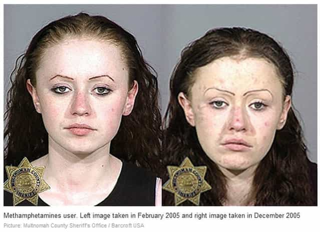 Methamphetamine. Before and After