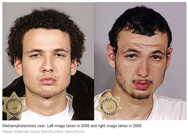 Methamphetamine. Before and After
