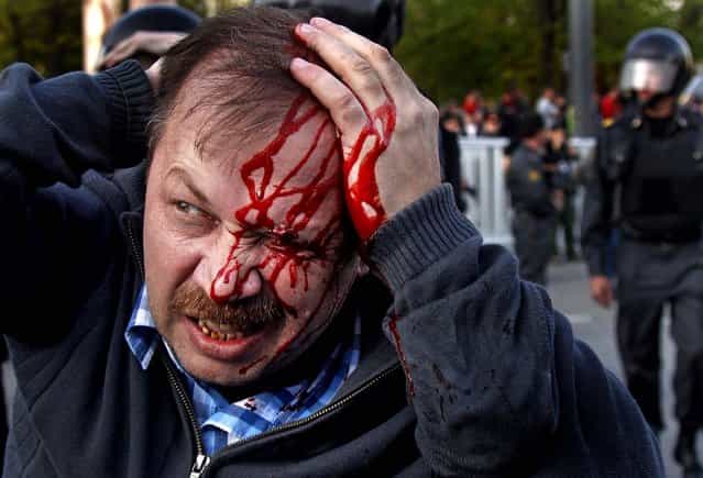 A wounded opposition protester winces in pain during a rally in Moscow on May 6, 2012
