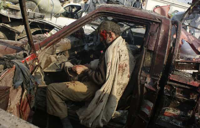 A man injured in a bomb blast puts on a shoe before being taken to the hospital in the Khyber region, near Peshawar, Pakistan, January 10, 2012. A bomb targeting a tribal militia opposed to the Pakistani Taliban exploded in a market close to the Afghan border Tuesday, killing dozens of people in the deadliest blast in the country in several months, officials said. (Photo by Qazi Rauf/AP Photo)