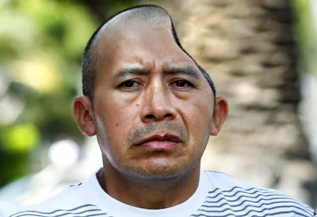 Antonio Lopez Chaj, a 43-year-old house painter, appears with his attorneys at a news conference in Los Angeles, on July 1, 2013. Lopez Chaj is so badly brain damaged from a beating in a bar that left him with half his skull permanently bashed in that he cannot speak. His lawyers announced he has been awarded a $58 million by a jury in Torrance Superior Court. (Photo by Nick Ut/Associated Press)