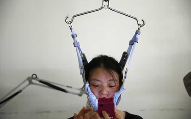 A woman checks her mobile phone as she receives treatment for cervical spondylosis at a hospital in Jiaxing, Zhejiang province July 12, 2013. (Photo by William Hong/Reuters)