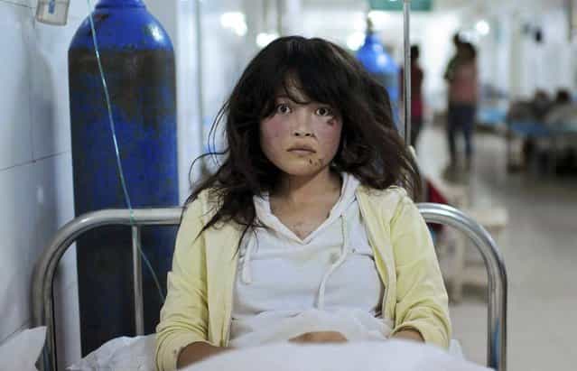 An injured woman receives treatment at a hospital after a 6.6 magnitude earthquake hit Minxian county, Dingxi, Gansu province July 23, 2013. The death toll from two earthquakes in China's western Gansu province has climbed to 95, with more than 1000 people injured, after around 51,800 buildings collapsed and tens of thousands more were badly damaged. Picture taken July 23, 2013. (Photo by Reuters/Stringer)