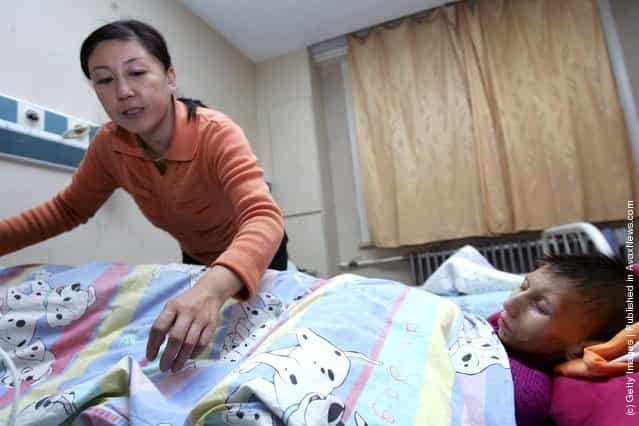 12-year-old Chinese girl Sun Yangyang suffering from Cockayne syndrome