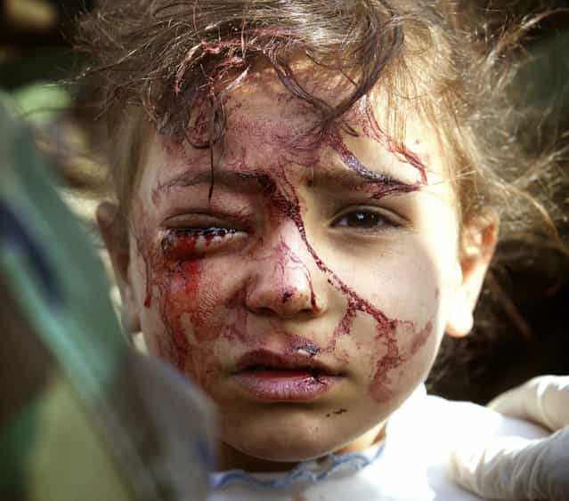 A wounded Iraqi girl is treated by U.S. marines in central Iraq, on March 29, 2003. The four-year old girl, blood streaming from an eye wound, was screaming for her dead mother, while her father, shot in a leg, begged to be freed from the plastic wrist cuffs slapped on him by U.S. marines, so he could hug his other terrified daughter. (Photo by Damir Sagolj/Reuters/The Atlantic)
