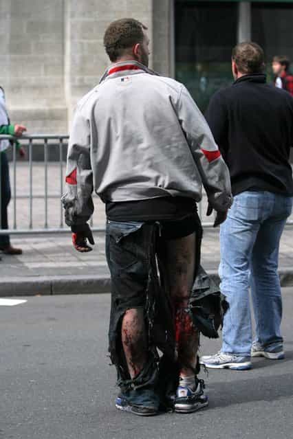 An injured man stands at the scene of an explosion at the Boston Marathon in Boston, Massachusetts, April 15, 2013. Two explosions struck the marathon as runners crossed the finish line on Monday, witnesses said, injuring an unknown number of people on what is ordinarily a festive day in the city. (Photo by Kenshin Okubo/Reuters/Daily Free Press/Boston University)