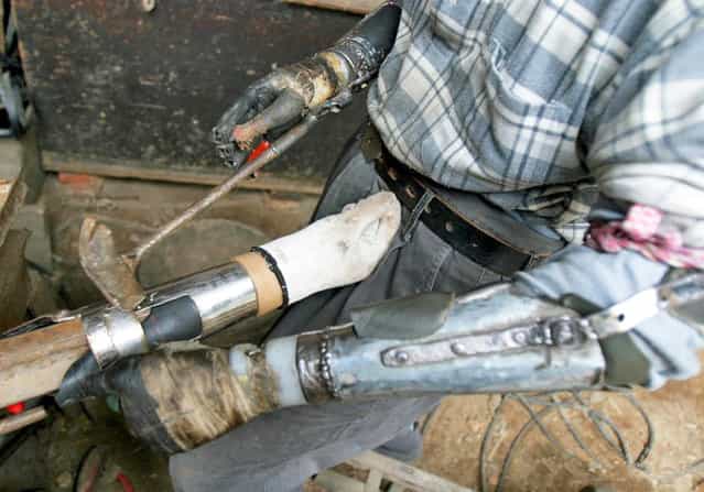 Farmer Builds Own Bionic Arms