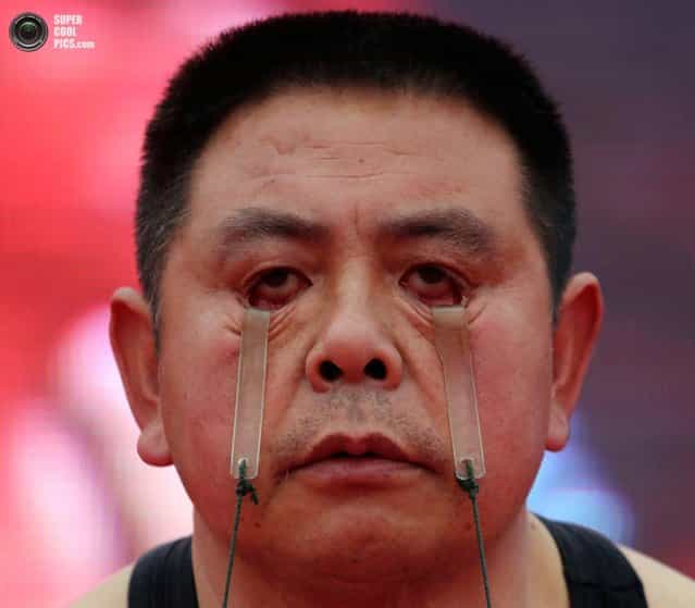 Wang Xianxiang Eyelid Weightlifter